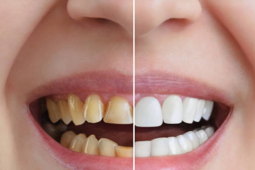 Cosmetic Dental Surgeon